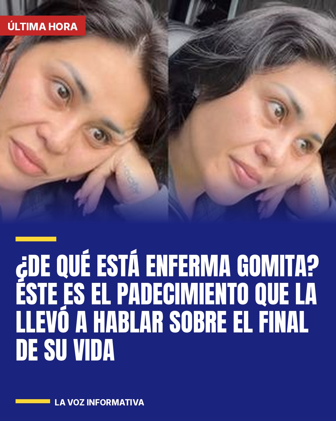 de-que-esta-enferma-gomita-este-es-el-padecimiento-que-la-llevo-a-hablar-sobre-e-cover
